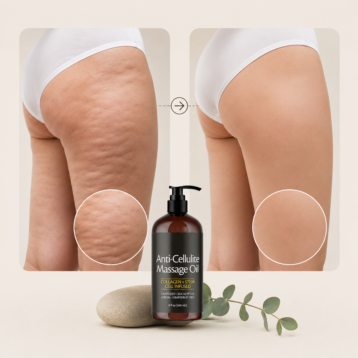 Royelia™ Anti-Cellulite Massage Oil