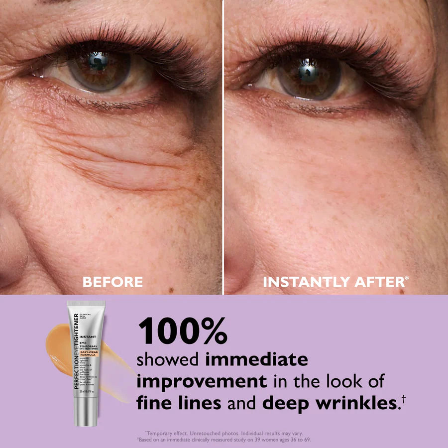 Royelia™ Instant Eye Tightening Cream