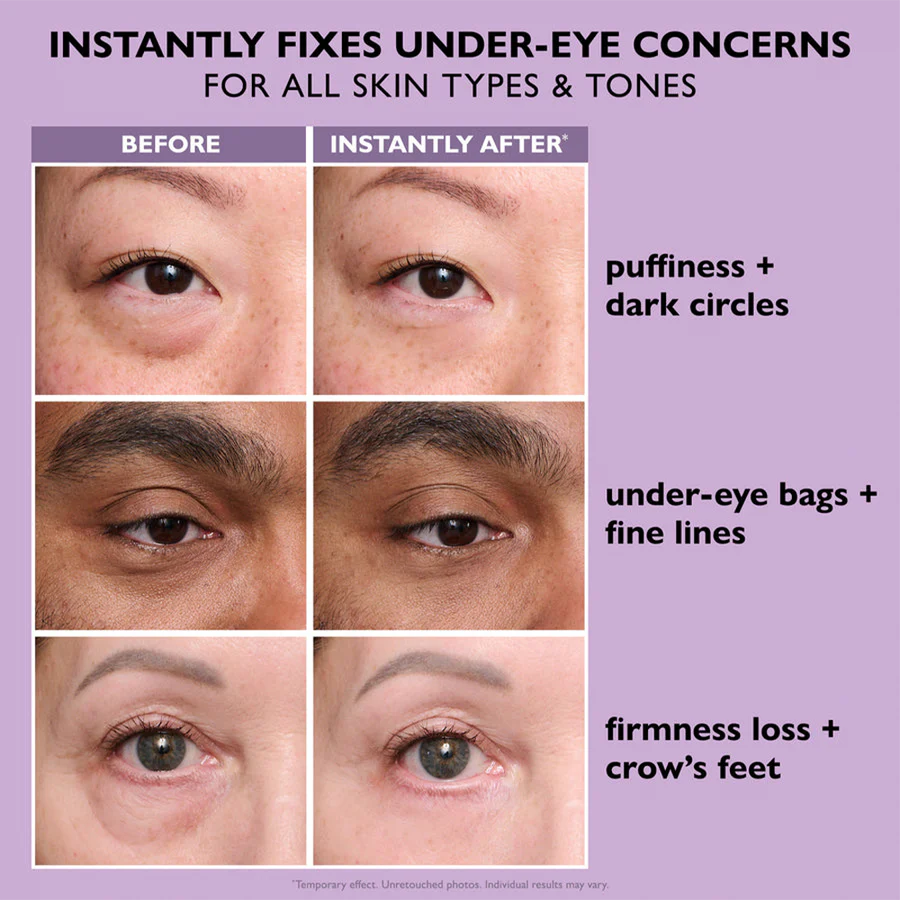 Royelia™ Instant Eye Tightening Cream